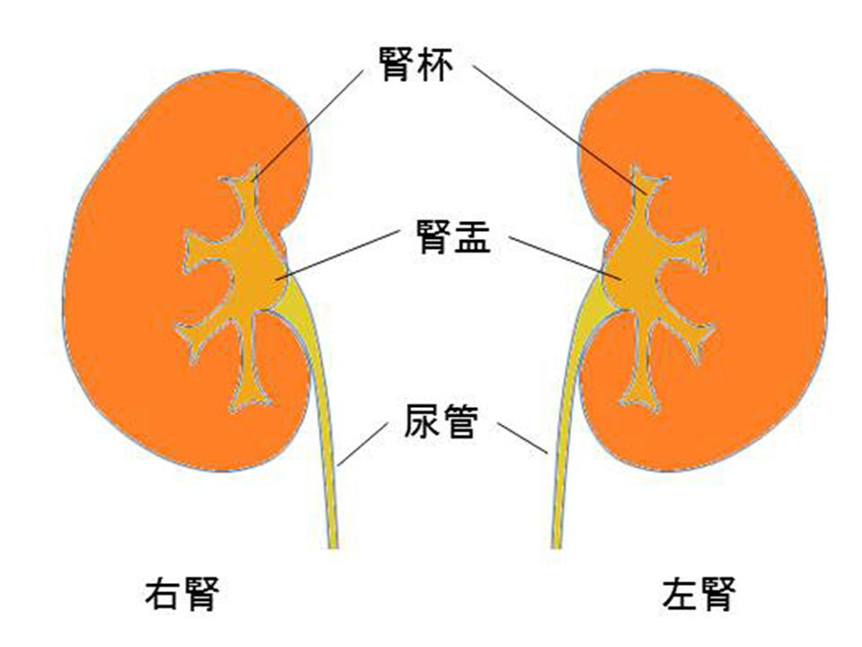 人工腎臓