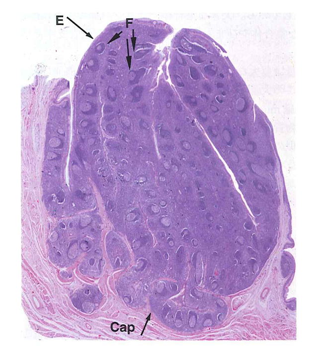 Palatine Tonsil Histology Labeled